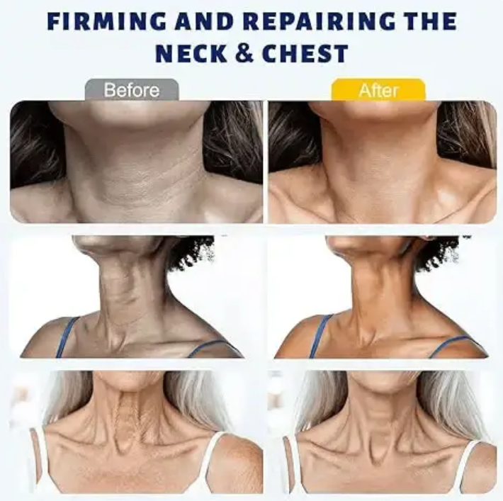 ✨Instant Neck Lift Cream — ✨ Infused with Retinol & Hyaluronic Acid | Firms the Neck, Reduces Wrinkles & Double Chin